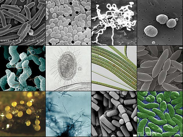By 148LENIN - Derivate work:EscherichiaColi NIAID.jpgEntercoccus sp2 lores.jpgTreponemaPallidum.jpgStreptococcus pneumoniae.jpgARS Campylobacter jejuni.jpgUltra-small bacteria.pngOscillatoria filaments.jpg41467 2020 20149 Fig1b.jpgMyxococcus xanthus.pngStreptomyces sp 01.pngBacillus cereus SEM-cr.jpgVibrio vulnificus 01.png, CC BY-SA 4.0, https://commons.wikimedia.org/w/index.php?curid=122618550