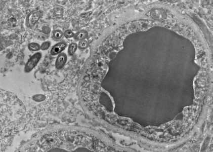 El maravilloso mundo del microbioma