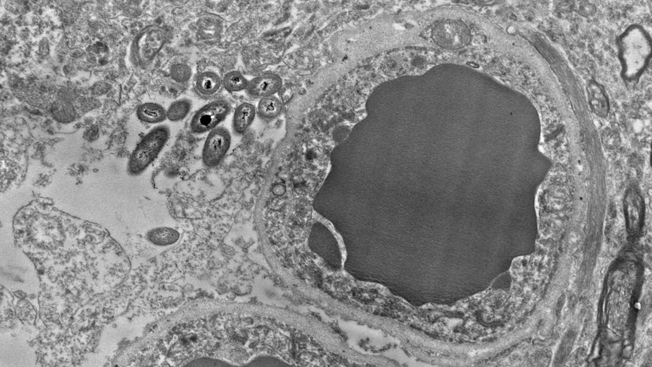 El maravilloso mundo del microbioma